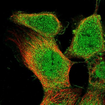 Anti-OLR1 antibody produced in rabbit affinity isolated antibody, buffered aqueous glycerol solution