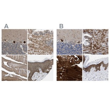 Anti-BAG3 antibody produced in rabbit Prestige Antibodies&#174; Powered by Atlas Antibodies, affinity isolated antibody, buffered aqueous glycerol solution, Ab2