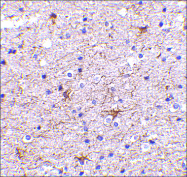 Anti-TMP21 (ab1) antibody produced in rabbit affinity isolated antibody, buffered aqueous solution