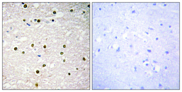 Anti-P73 antibody produced in rabbit affinity isolated antibody