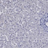Anti-CTNNBIP1 antibody produced in rabbit Prestige Antibodies® Powered by Atlas Antibodies, affinity isolated antibody, buffered aqueous glycerol solution