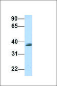 Anti-SRRD antibody produced in rabbit affinity isolated antibody