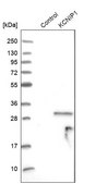 Anti-KCNIP1 antibody produced in rabbit Prestige Antibodies® Powered by Atlas Antibodies, affinity isolated antibody, buffered aqueous glycerol solution