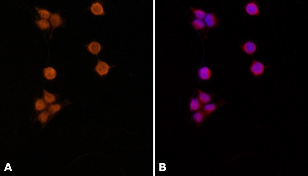 Anti-MSH6 (N-terminal) antibody produced in rabbit IgG fraction of antiserum, buffered aqueous solution