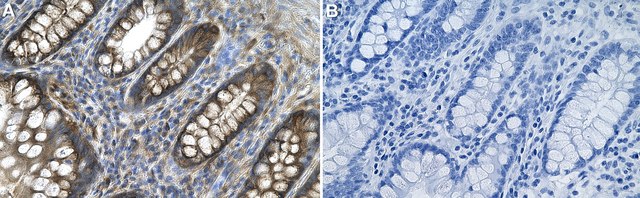 Anti-DICER1 Antibody, clone 1E4 ZooMAb&#174; Rabbit Monoclonal recombinant, expressed in HEK 293 cells