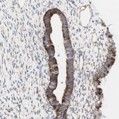 Anti-AGPAT5 antibody produced in rabbit Prestige Antibodies® Powered by Atlas Antibodies, affinity isolated antibody, buffered aqueous glycerol solution