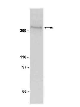 Anti-phospho-Acetyl CoA Carboxylase (Ser79) Antibody, clone BK102 clone BK102, Upstate&#174;, from mouse