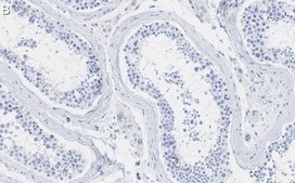 Anti-ANKRD11 Antibody, clone 1H14 ZooMAb® Rabbit Monoclonal recombinant, expressed in HEK 293 cells