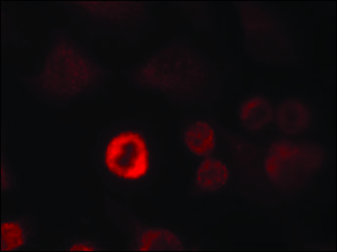 Anti-Snca (Ab-136) antibody produced in rabbit affinity isolated antibody