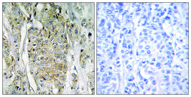 Anti-HER2 antibody produced in rabbit affinity isolated antibody