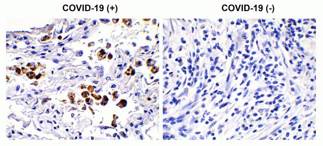 Anti-SARS-CoV-2 (COVID-19) Spike S2 antibody produced in rabbit affinity isolated antibody