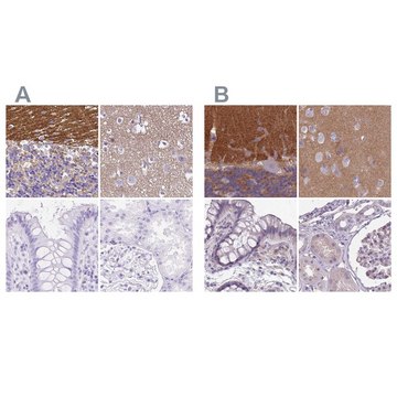 Anti-SLC8A2 antibody produced in rabbit Prestige Antibodies&#174; Powered by Atlas Antibodies, affinity isolated antibody, buffered aqueous glycerol solution