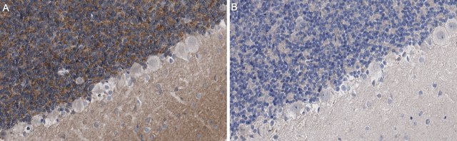 Anti-KCNT1 Antibody