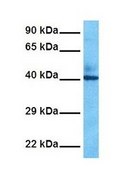 Anti-FADS1 antibody produced in rabbit IgG fraction of antiserum