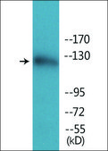 Anti-phospho-Abl (pTyr412) antibody produced in rabbit affinity isolated antibody