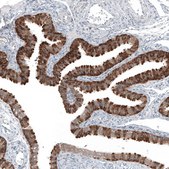 Anti-COL12A1 antibody produced in rabbit Prestige Antibodies® Powered by Atlas Antibodies, affinity isolated antibody, buffered aqueous glycerol solution