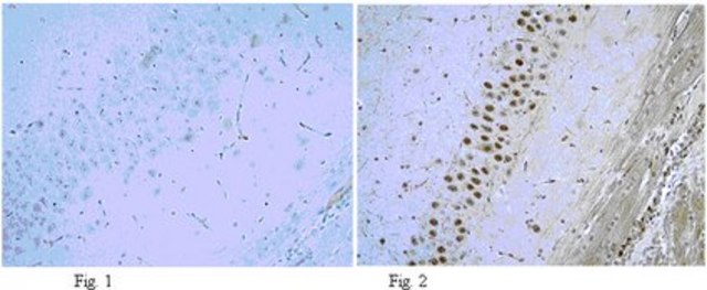 Anti-phospho-NR1 (Ser896) Antibody from rabbit, purified by affinity chromatography