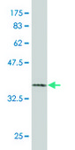 Monoclonal Anti-PHKB antibody produced in mouse clone 2E9, purified immunoglobulin, buffered aqueous solution