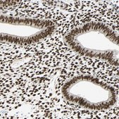 抗-CDK12 兔抗 Prestige Antibodies® Powered by Atlas Antibodies, affinity isolated antibody, buffered aqueous glycerol solution