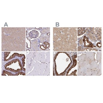 Anti-TPD52 antibody produced in rabbit Prestige Antibodies&#174; Powered by Atlas Antibodies, affinity isolated antibody, buffered aqueous glycerol solution