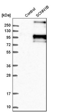 Anti-SCNN1B antibody produced in rabbit Prestige Antibodies&#174; Powered by Atlas Antibodies, affinity isolated antibody, buffered aqueous glycerol solution