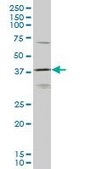 Monoclonal Anti-HOXD11, (N-terminal) antibody produced in mouse clone 6C8, purified immunoglobulin, buffered aqueous solution