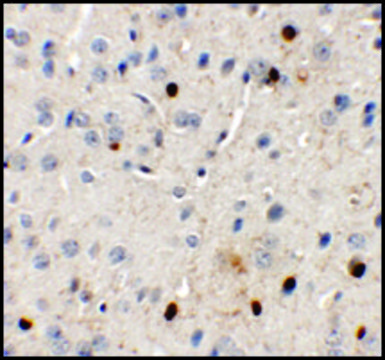 Anti-SPRYD3 antibody produced in rabbit affinity isolated antibody