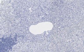 Anti-Dopamine β Hydroxylase Antibody, clone 2B11 ZooMAb® Rabbit Monoclonal recombinant, expressed in HEK 293 cells