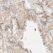 Anti-ARID5A antibody produced in rabbit Prestige Antibodies® Powered by Atlas Antibodies, affinity isolated antibody, buffered aqueous glycerol solution