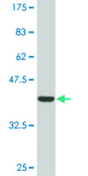 Monoclonal Anti-DSCR1 antibody produced in mouse clone 1G7, ascites fluid