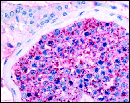 Anti-FZD9 (AB2) antibody produced in rabbit affinity isolated antibody, buffered aqueous solution