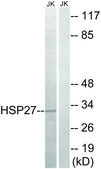 Anti-HSP27 antibody produced in rabbit affinity isolated antibody