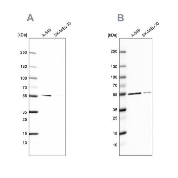 Anti-GPI antibody produced in rabbit Prestige Antibodies&#174; Powered by Atlas Antibodies, affinity isolated antibody