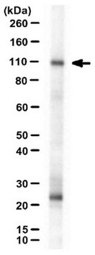 Anti-Neph1 Antibody, cytoplasmic domain from rabbit, purified by affinity chromatography