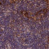 Anti-SPRYD3 antibody produced in rabbit Prestige Antibodies® Powered by Atlas Antibodies, affinity isolated antibody, buffered aqueous glycerol solution