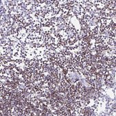 Anti-CD5 antibody produced in rabbit Prestige Antibodies® Powered by Atlas Antibodies, affinity isolated antibody, buffered aqueous glycerol solution
