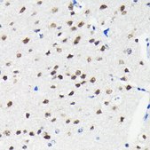 Anti-Cullin 3 antibody produced in rabbit