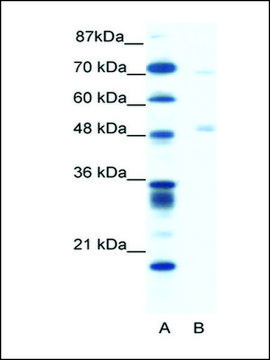 Anti-PNLIP (AB1) antibody produced in rabbit IgG fraction of antiserum