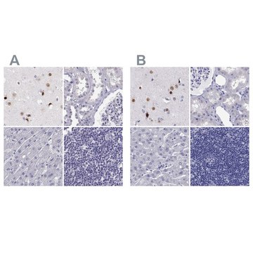 Anti-TBR1 Prestige Antibodies&#174; Powered by Atlas Antibodies, affinity isolated antibody