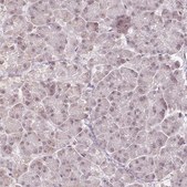 Anti-DEK antibody produced in rabbit Prestige Antibodies® Powered by Atlas Antibodies, affinity isolated antibody, buffered aqueous glycerol solution