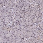 Anti-NIP7 antibody produced in rabbit Prestige Antibodies® Powered by Atlas Antibodies, affinity isolated antibody, buffered aqueous glycerol solution
