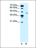 Anti-GPR161 antibody produced in rabbit affinity isolated antibody