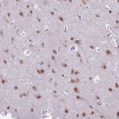 Anti-NOVA2 antibody produced in rabbit Prestige Antibodies® Powered by Atlas Antibodies, affinity isolated antibody, buffered aqueous glycerol solution