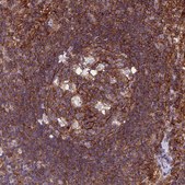 Anti-PPP1R18 antibody produced in rabbit Prestige Antibodies® Powered by Atlas Antibodies, affinity isolated antibody, buffered aqueous glycerol solution