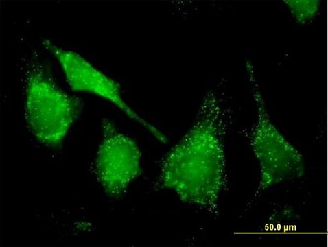 Anti-CAT antibody produced in mouse purified immunoglobulin, buffered aqueous solution