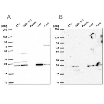 Anti-CMPK1 antibody produced in rabbit Prestige Antibodies® Powered by Atlas Antibodies, affinity isolated antibody, buffered aqueous glycerol solution