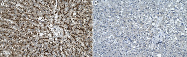 Anti-LAMP2 Antibody, clone H4B4 ZooMAb&#174; Mouse Monoclonal recombinant, expressed in HEK 293 cells