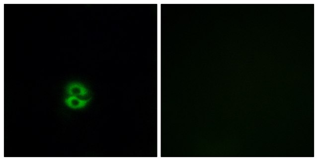 Anti-CHST6 antibody produced in rabbit affinity isolated antibody