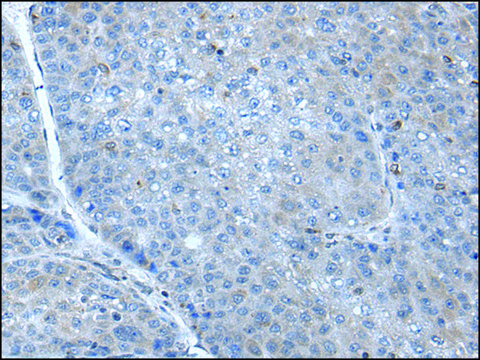 Anti-SCGB3A1 affinity isolated antibody