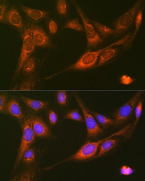 Anti-RALBP1 Antibody, clone 5C10W9, Rabbit Monoclonal